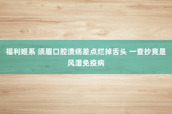 福利姬系 须眉口腔溃疡差点烂掉舌头 一查抄竟是风湿免疫病